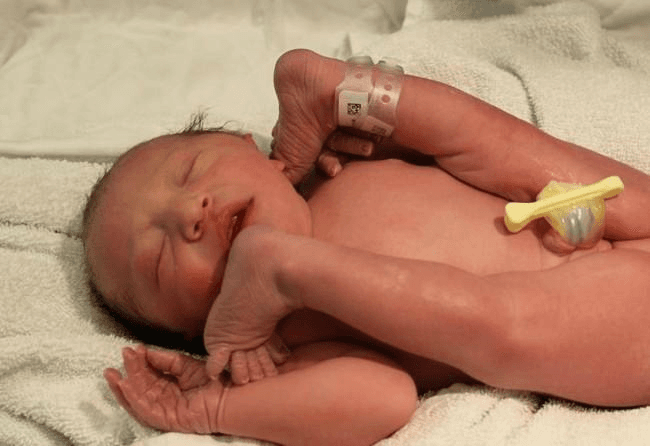 Amazing photo shows how a breach baby fits in the womb