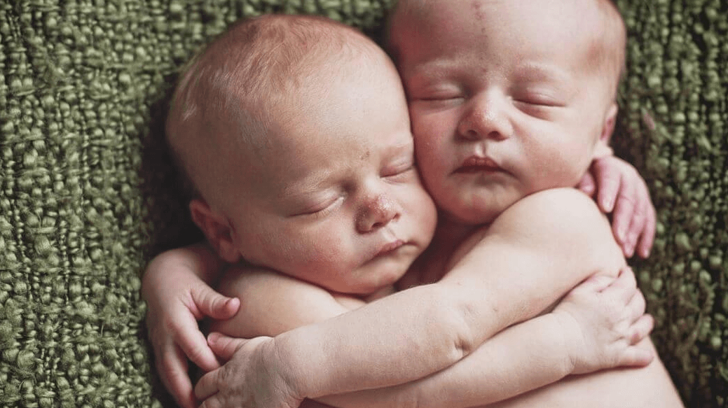 This mum gave her newborn twins the same name – and people have opinions