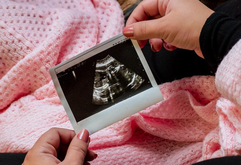 My mother-in-law wants our baby to call her mama- is this a step too far?