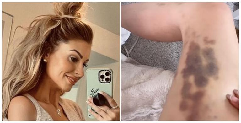 Mrs Hinch reveals why she always covers up – even in summer