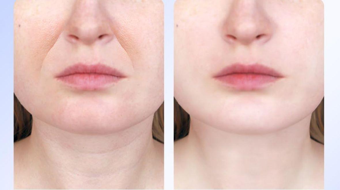 Shoppers ditch anti-ageing creams for €20 gadget designed to tighten skin