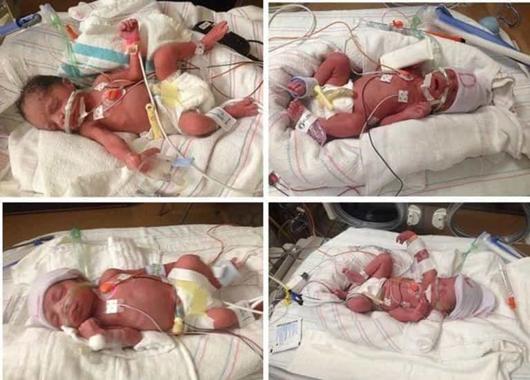 NEWS: Arizona woman dies after giving birth to quadruplets NEWS: Arizona woman dies after giving birth to quadruplets