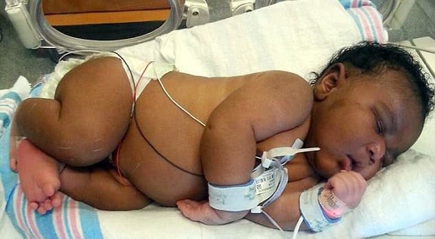 Whoa Baby! Florida woman gives birth to 14lb son Whoa Baby! Florida woman gives birth to 14lb son