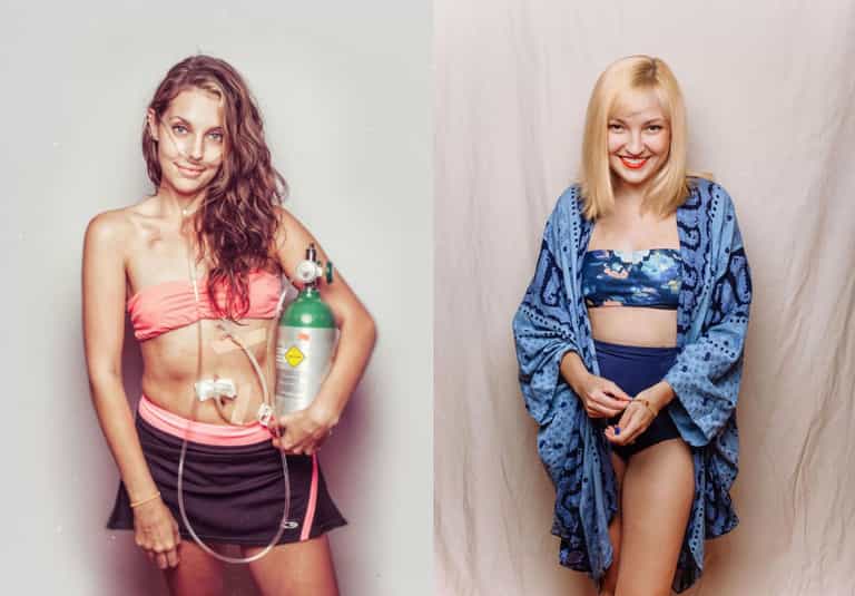 Fashion photographer’s beautiful images of women with Cystic Fibrosis Fashion photographer’s beautiful images of women with Cystic Fibrosis
