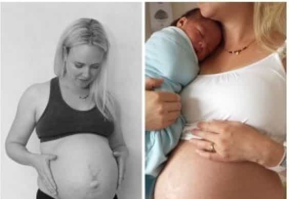 Why this mum wants to show you her post-baby body Why this mum wants to show you her post-baby body