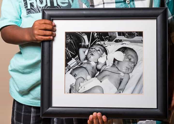Intimate before-and-after photos of premature babies Intimate before-and-after photos of premature babies