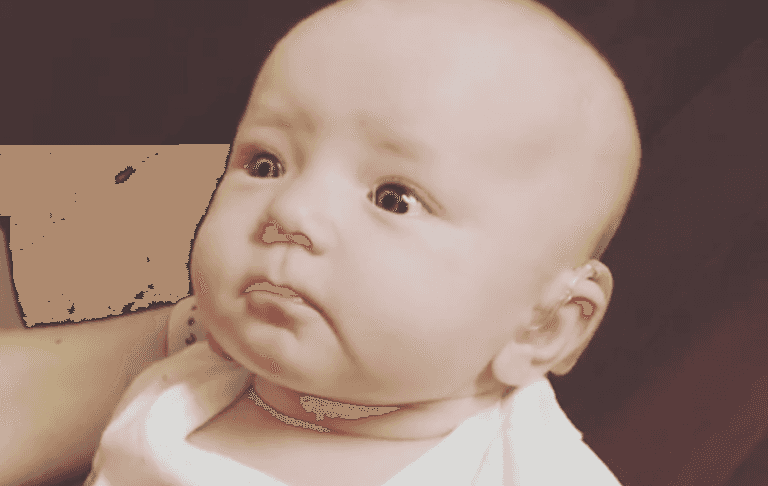 Video of ‘profoundly deaf’ baby hearing mum speak for first time Video of ‘profoundly deaf’ baby hearing mum speak for first time