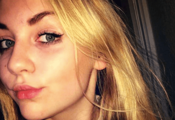 Girl who shaved her head for cancer charity ‘put in isolation’ in school Girl who shaved her head for cancer charity ‘put in isolation’ in school