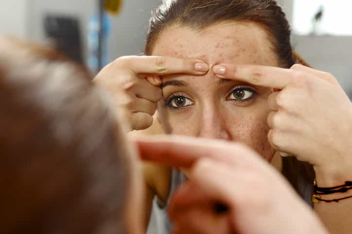So here’s the reason behind breakouts on each part of your face So here’s the reason behind breakouts on each part of your face