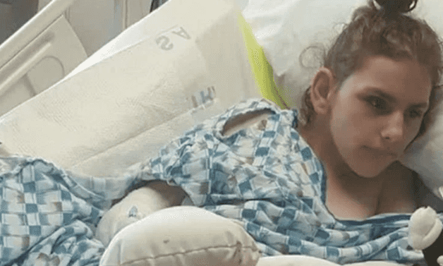 Carers admit to bathing teen with disabilities in bleach causing severe chemical burns Carers admit to bathing teen with disabilities in bleach causing severe chemical burns