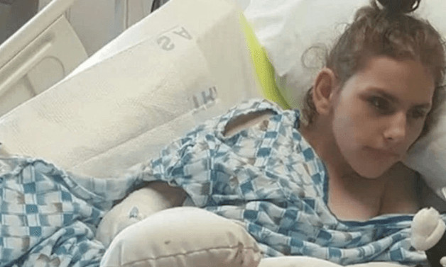 Carers admit to bathing teen with disabilities in bleach causing severe chemical burns Carers admit to bathing teen with disabilities in bleach causing severe chemical burns