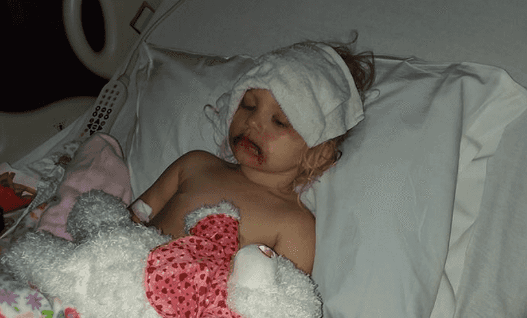 One toddler ended up in hospital covered in blisters after using kids makeup One toddler ended up in hospital covered in blisters after using kids makeup
