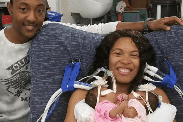 Mum pays heartbreaking tribute to her conjoined baby girls who passed away Mum pays heartbreaking tribute to her conjoined baby girls who passed away
