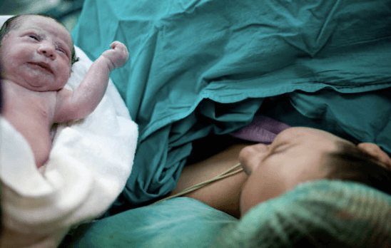 C-section and induction rates increasing for first-time mums in Ireland C-section and induction rates increasing for first-time mums in Ireland