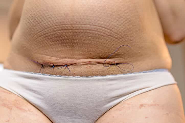 Mum explains why she was ‘too smart to push’ when giving birth Mum explains why she was ‘too smart to push’ when giving birth