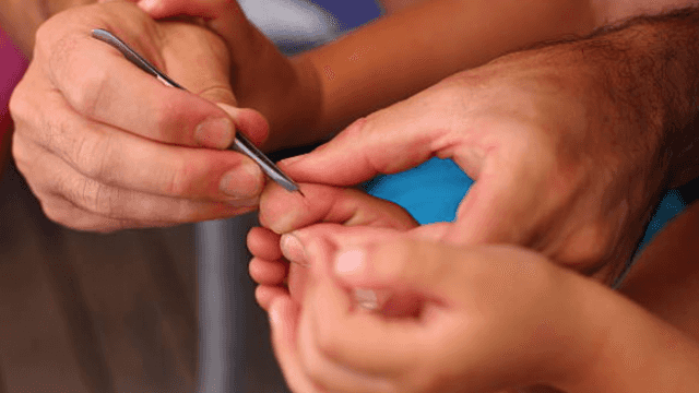One mum shared the most genius trick for getting out splinters – and it is SO simple One mum shared the most genius trick for getting out splinters – and it is SO simple