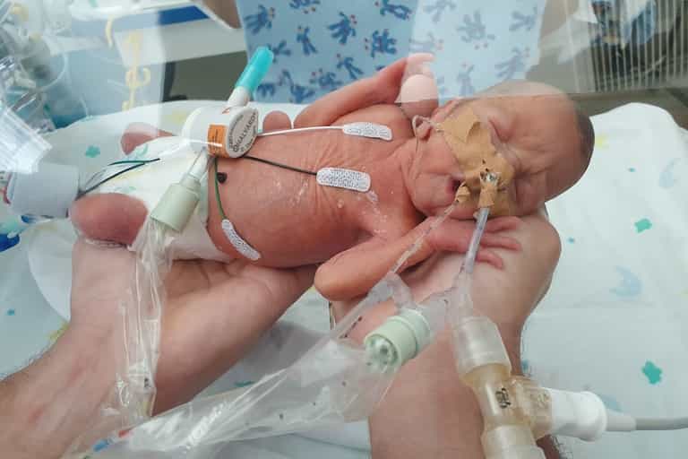 Preemie expected to be born brain dead at 23 weeks now taking first steps Preemie expected to be born brain dead at 23 weeks now taking first steps