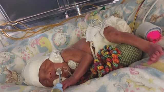 Premature baby whose mum had Covid dies of the virus at 9 days old Premature baby whose mum had Covid dies of the virus at 9 days old