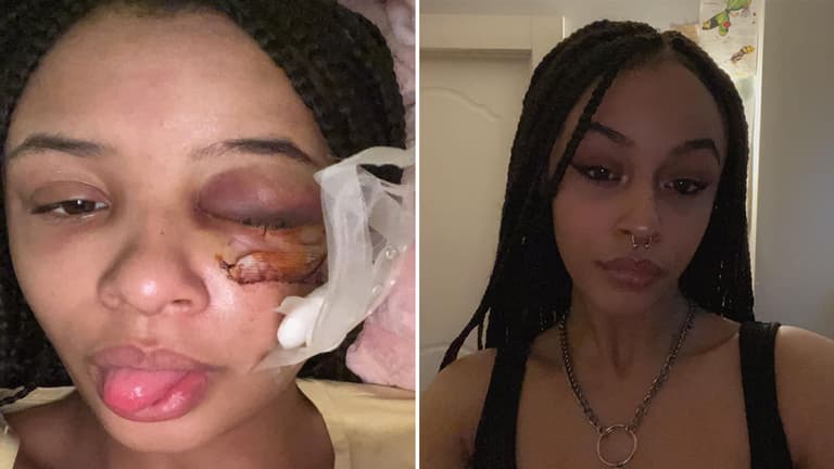 Mother of Alanna Quinn Idris reveals people keep staring at her daughter Mother of Alanna Quinn Idris reveals people keep staring at her daughter