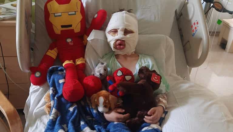 6-year-old boy left “scarred for life” after bullies allegedly set him on fire in US 6-year-old boy left “scarred for life” after bullies allegedly set him on fire in US