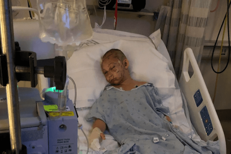 9-year-old girl miraculously survives cougar attack 9-year-old girl miraculously survives cougar attack