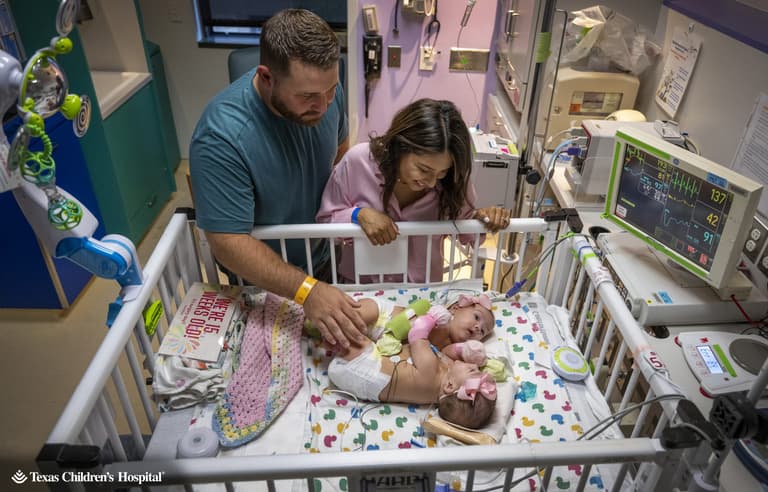 Conjoined twins go home after six hour separation surgery is a succuss Conjoined twins go home after six hour separation surgery is a succuss