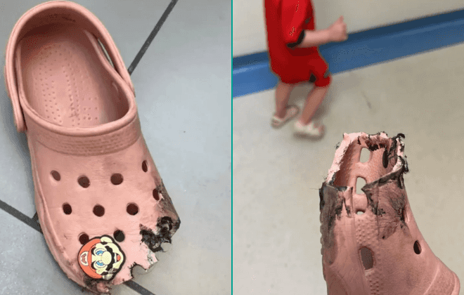 Mum issues warning about wearing Crocs after daughter’s ‘freak accident’ Mum issues warning about wearing Crocs after daughter’s ‘freak accident’