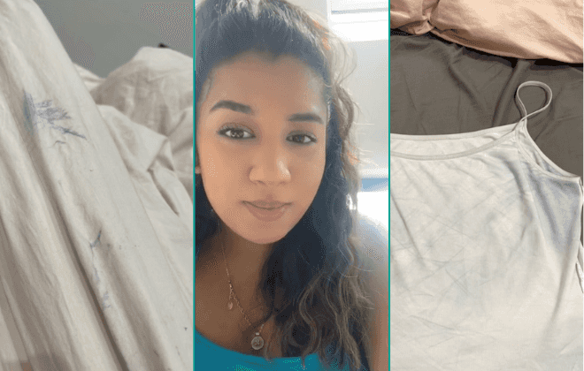 Chromhidrosis and pregnancy: The rare condition explained Chromhidrosis and pregnancy: The rare condition explained