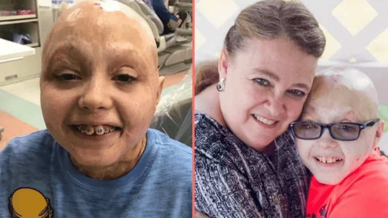 Two-year-old with ‘0 per cent chance of survival’ after burning 98 per cent of his body is now inspiring others Two-year-old with ‘0 per cent chance of survival’ after burning 98 per cent of his body is now inspiring others