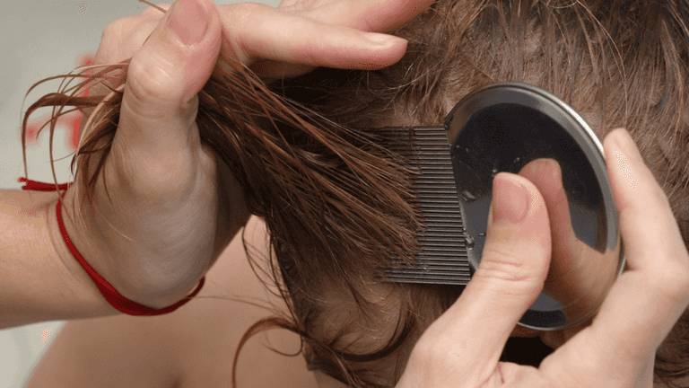 ‘My vegan neighbours won’t remove lice from their child’s hair because it’s cruel’ ‘My vegan neighbours won’t remove lice from their child’s hair because it’s cruel’
