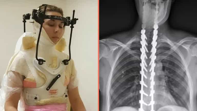 Woman has skull reattached after being ‘decapitated’ in freak football injury Woman has skull reattached after being ‘decapitated’ in freak football injury