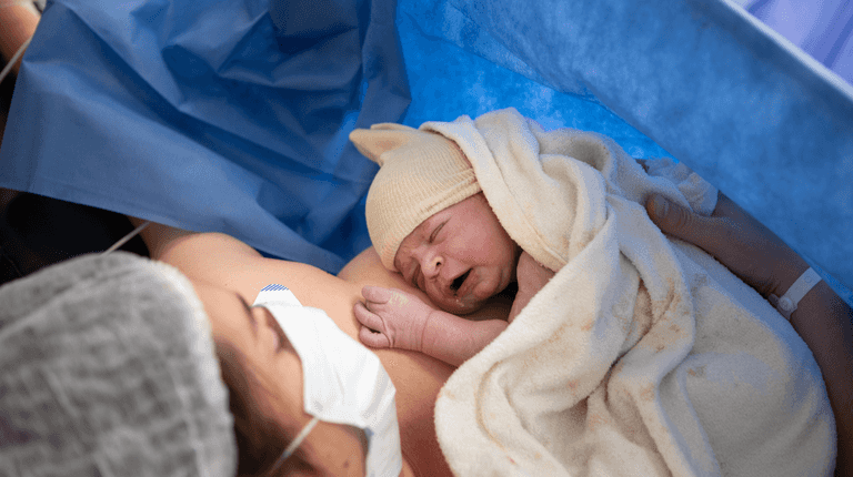 Over 40% of women had caesarean sections in 2024, HSE reports Over 40% of women had caesarean sections in 2024, HSE reports