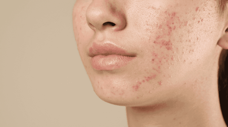‘I’m a dermatologist and I swear by this one thing for fading scars’ ‘I’m a dermatologist and I swear by this one thing for fading scars’