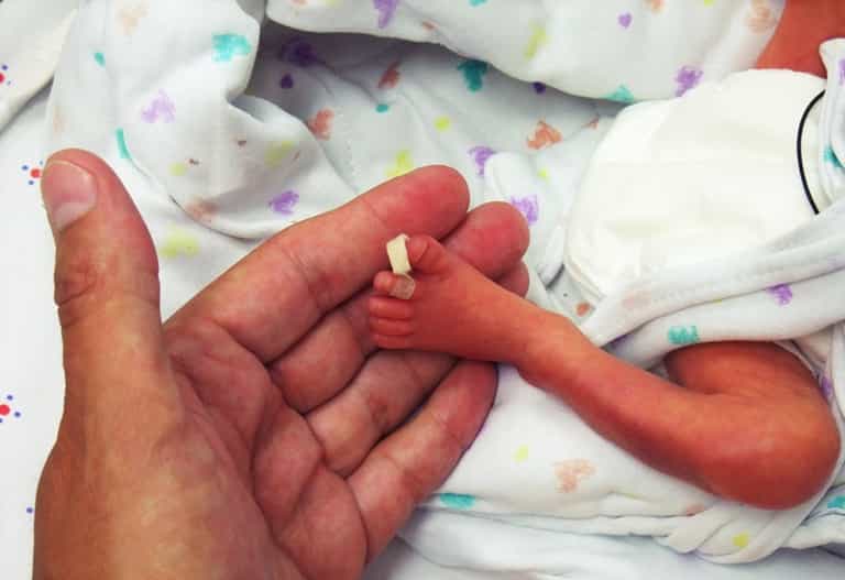 Ireland’s SIDS rate has declined but premies are still at greater risk Ireland’s SIDS rate has declined but premies are still at greater risk