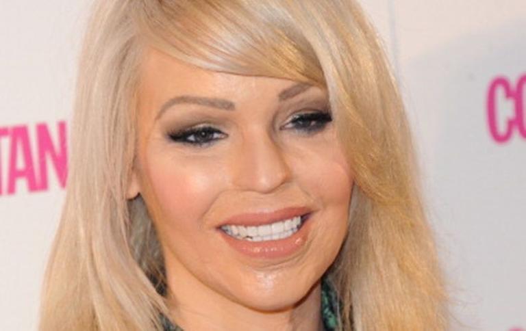 Katie Piper’s 10-year challenge is both devastating and completely inspiring Katie Piper’s 10-year challenge is both devastating and completely inspiring