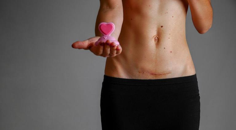 Mother-of-five donates her uterus to couple experiencing infertility Mother-of-five donates her uterus to couple experiencing infertility