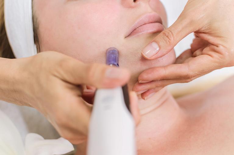 I tried Nano-Needling for the first time and it left my face absolutely glowing I tried Nano-Needling for the first time and it left my face absolutely glowing