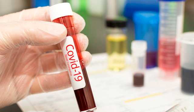 People seeking Covid-19 tests must display two symptoms under new criteria People seeking Covid-19 tests must display two symptoms under new criteria