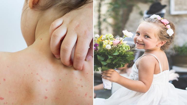 Bride asks to remove niece as flower girl “because of how she looks” Bride asks to remove niece as flower girl “because of how she looks”