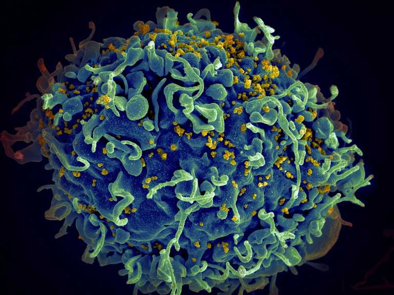 Woman cured of HIV for first time ever in ‘scientifically important’ breakthrough Woman cured of HIV for first time ever in ‘scientifically important’ breakthrough