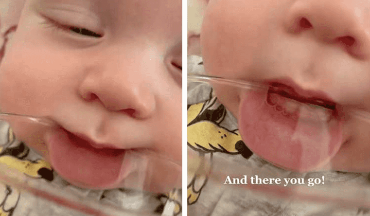This clever trick makes it easy to know if your baby has started teething This clever trick makes it easy to know if your baby has started teething