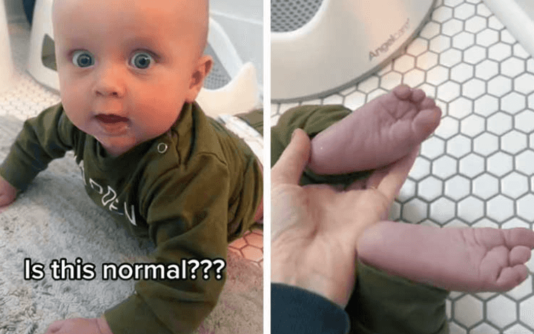 “Is this normal?” Mum shares image of her baby’s purple feet and TikTok-ers help “Is this normal?” Mum shares image of her baby’s purple feet and TikTok-ers help