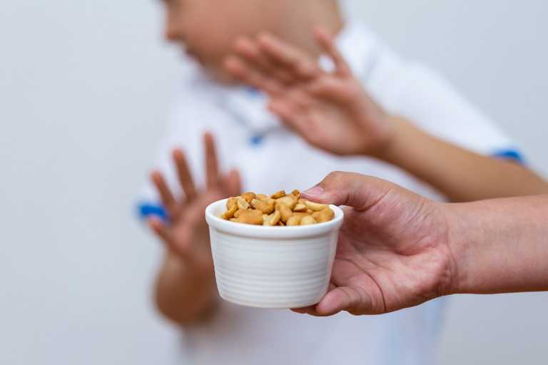 Four early signs of a nut allergy in kids – and what to do Four early signs of a nut allergy in kids – and what to do