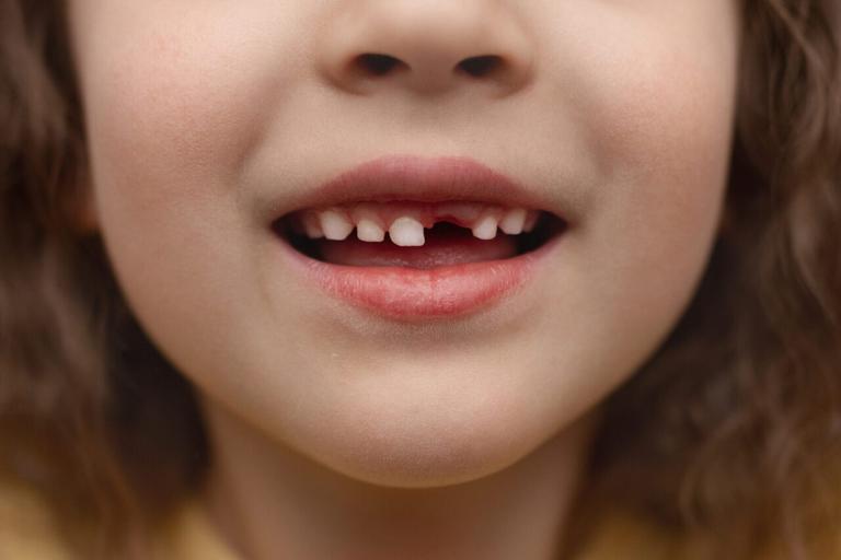 Mum reveals how much the Tooth Fairy pays for her daughter’s teeth due to inflation Mum reveals how much the Tooth Fairy pays for her daughter’s teeth due to inflation