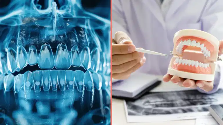 Cause of Alzheimer’s might be coming from inside your mouth, scientists find Cause of Alzheimer’s might be coming from inside your mouth, scientists find