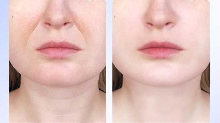 Shoppers ditch anti-ageing creams for €20 gadget designed to tighten skin Shoppers ditch anti-ageing creams for €20 gadget designed to tighten skin