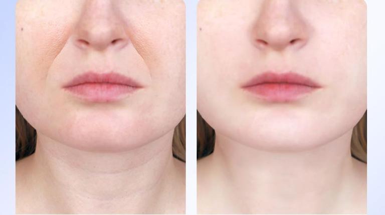 Shoppers ditch anti-ageing creams for €20 gadget designed to tighten skin Shoppers ditch anti-ageing creams for €20 gadget designed to tighten skin