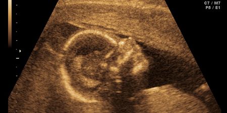 Ultrasound scan images reveal harmful effects of smoking during pregnancy