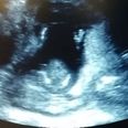WATCH: Incredible scan film shows baby clapping along with mum’s singing