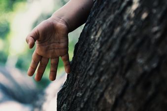Parent hack: how to remove a splinter (without using tweezers)